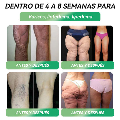 La Elección de los Expertos Españoles👩‍⚕️|💕𝐋𝐎𝐓𝐌𝐀𝐘® 𝐆𝐋𝐏-𝟏 - 𝐀𝐦𝐩𝐨𝐥𝐥𝐚𝐬 𝐎𝐫𝐚𝐥𝐞𝐬 𝐝𝐞 𝐌ú𝐥𝐭𝐢𝐩𝐥𝐞 𝐀𝐜𝐜𝐢ó𝐧 (𝐉𝐮𝐬𝐭 𝐨𝐧𝐜𝐞 𝐚 𝐝𝐚𝐲, 𝐯𝐢𝐬𝐢𝐛𝐥𝐞 𝐜𝐡𝐚𝐧𝐠𝐞𝐬 𝐢𝐧 𝟕 𝐝𝐚𝐲𝐬) 𝐅𝐨𝐫 𝐨𝐛𝐞𝐬𝐢𝐭𝐲, 𝐜𝐚𝐫𝐝𝐢𝐨𝐯𝐚𝐬𝐜𝐮𝐥𝐚𝐫 𝐡𝐞𝐚𝐥𝐭𝐡, 𝐝𝐢𝐚𝐛𝐞𝐭𝐞𝐬, 𝐬𝐥𝐞𝐞𝐩 𝐚𝐩𝐧𝐞𝐚, 𝐆𝐮𝐭 𝐇𝐞𝐚𝐥𝐭𝐡, 𝐣𝐨𝐢𝐧𝐭 𝐢𝐬𝐬𝐮𝐞𝐬, 𝐚𝐧𝐝 𝐦𝐨𝐫𝐞⚓